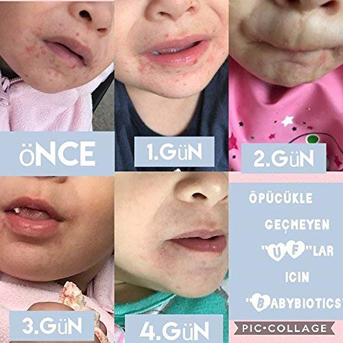 Siani BabyBiotics - Topical Probiotic Body Care for Children of All Ages 4oz -Hypoallergenic  Vegan  Non GMO  GF  100% Natural Live Probiotic  External + Internal Use  Totally Safe  No Refrigeration - Image 4